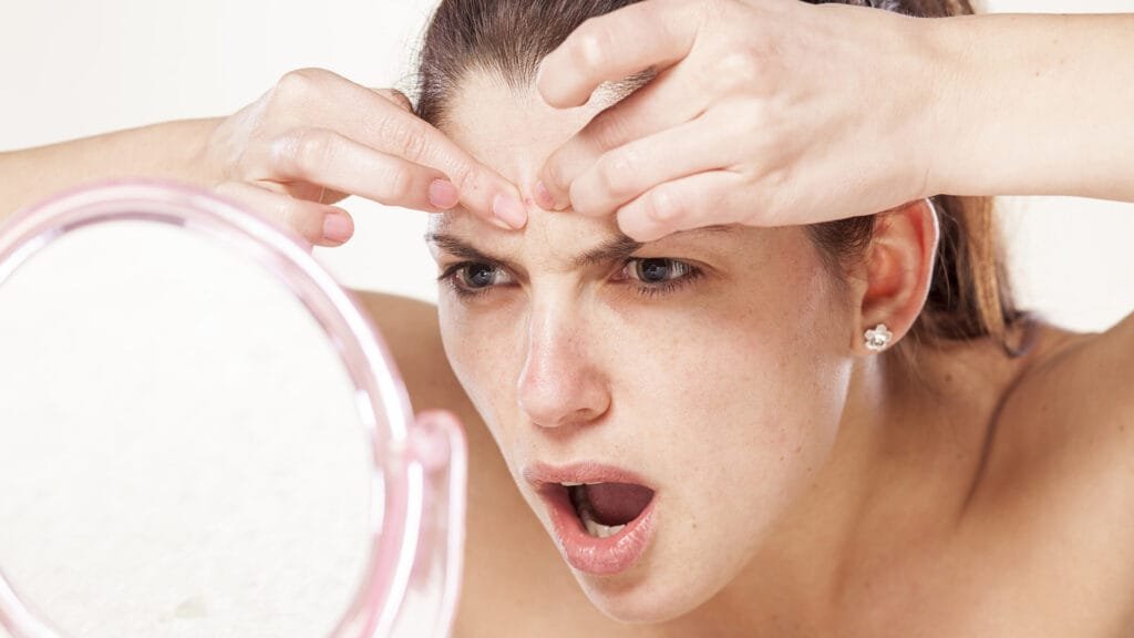 Mujer exprimiendo un grano frente al espejo, rostro con expresión de preocupación. Problemas comunes de la piel como el acné, granos hormonales y puntos negros. Hábitos negativos en el cuidado facial que empeoran la piel. Imagen ideal para temas de skincare, soluciones contra el acné, rutinas de limpieza facial y consejos para no tocar los granos asi podrascomo desinflamar rapido un grano.
